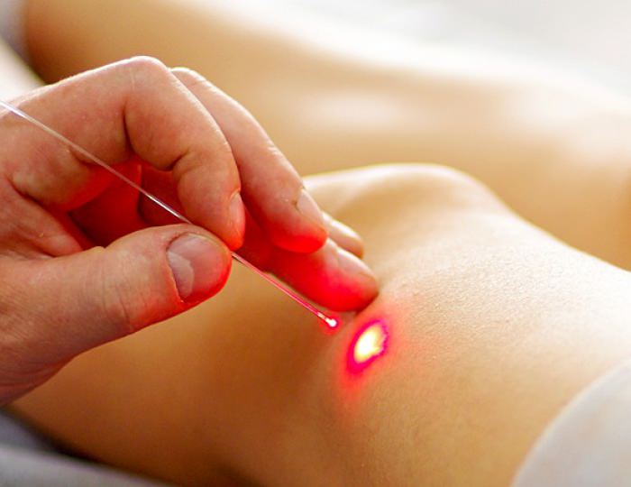 Крио- и лазерная терапии - Санаторий «Боровое» Крио- и лазерная терапии - Санаторий «Боровое»